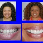 Business 5 image BARRY P. GIBBERMAN, DMD Teeth Whitening in Cincinnati OH