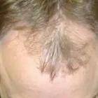 Business 2 image MEN'S HAIR GROWTH CENTER Hair Removal in Cincinnati OH