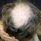 Business 3 image MEN'S HAIR GROWTH CENTER Hair Removal in Cincinnati OH