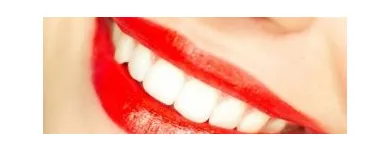 Business 2 image BARRY P. GIBBERMAN, DMD Teeth Whitening in Cincinnati OH