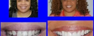 Business 5 image BARRY P. GIBBERMAN, DMD Teeth Whitening in Cincinnati OH